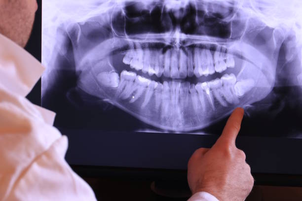 Best Mobile Emergency Dentist in Forsyth, MT