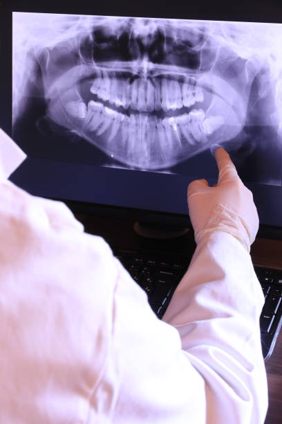 Best Emergency Root Canal Treatment in Forsyth, MT