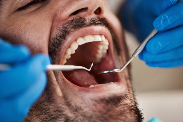 Best Emergency Dentist for Knocked-Out Tooth in Forsyth, MT