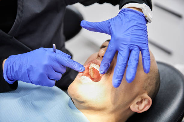 Best Emergency Dental Care for Abscessed Tooth in Forsyth, MT