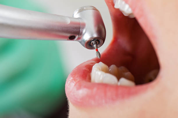 Best Weekend Emergency Dentist in Forsyth, MT